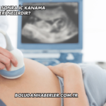 Sezaryenden Sonra İç Kanama Belirtileri Nelerdir?